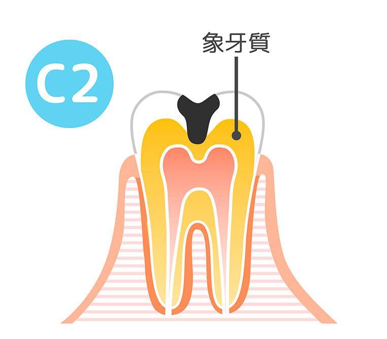 治療方法